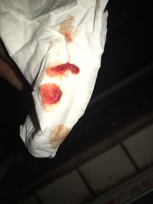 男生流出来黏黏的东西是