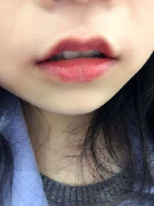 女生唇毛