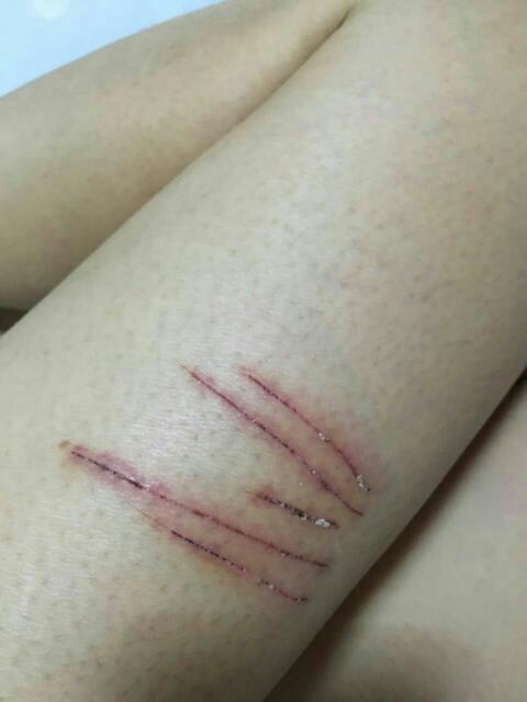 吵架就自残的女人是不是心理疾病