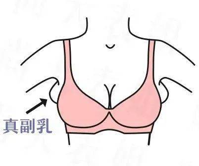 男生如果胸大怎么办有什么办法