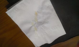 女生内裤上有白色果冻状分泌物是什么原因