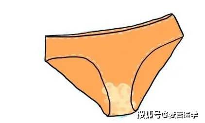 为什么女生的内裤上有黏黏的分泌物