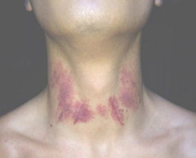 男生和女生种草莓怎么种