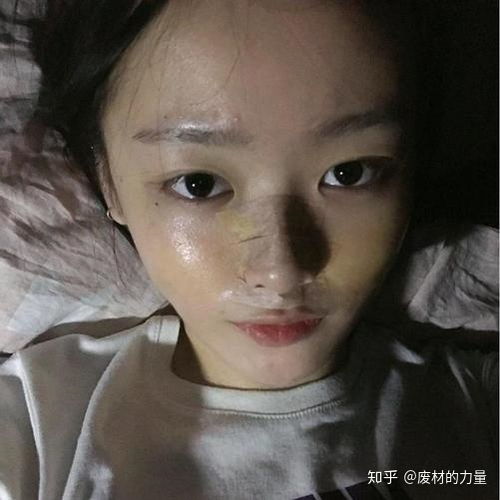 女生鼻子太大怎么办