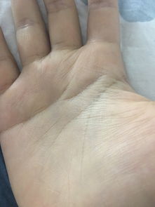 感情线断开错位图解