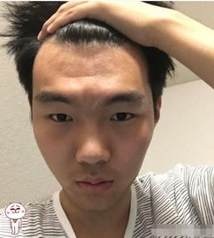 细长眼睛的男人