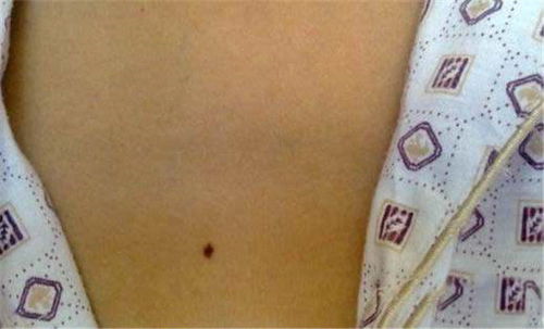 男人10处有痣是富贵痣 必成大器的男人痣