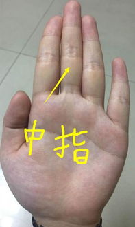 男人撞红预示着什么运气 男人撞红多久出现症状