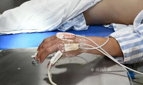 男人梦见自己左手被蛇咬了 梦见蛇咬左手出了点血