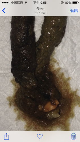 男人梦见自己拉稀屎裤裆里 梦见自己拉稀像喷水一样