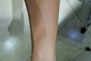 男人梦见自己被刀捅流血了 梦见自己受刀伤流血是什么预兆