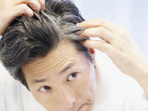 男人梦见自己满头白发 梦见自己一头白发周公解梦