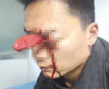 男人脑袋大代表什么 男人脑袋大命运好不好