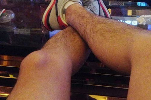 男人腿毛少是肾虚吗 男人肾好十大特点