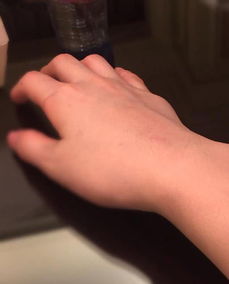 男朋友受伤了心疼话语 安慰手受伤的人的暖心话