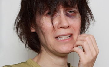 男人黑眼圈很重面相好不好 男人眼圈发黑是什么原因