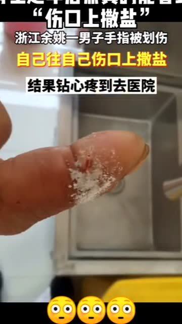 男生和我说他手划伤了 男人向你展示他的伤口