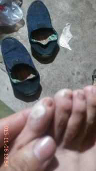 男生的鸡里面的白色东西是什么 小鸡鸡里有白色分泌物是什么