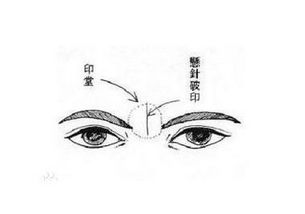 羊眼面相的男人 羊眼面相代表人物