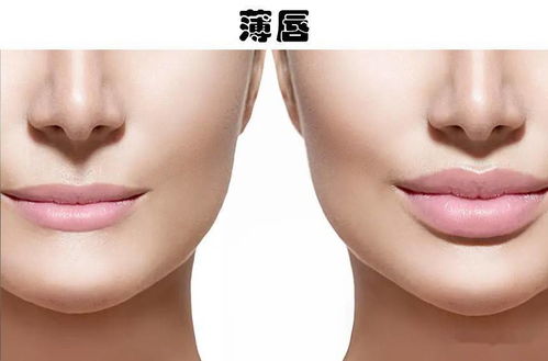老婆嘴是什么特征 俗称的老婆嘴是地包天吗
