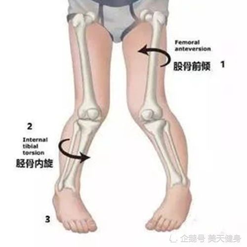 走路内八的男人那方面 男的走路内八字脚的命