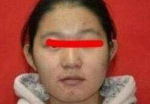 额头窄的男人是穷命吗 额头太窄怎么改善