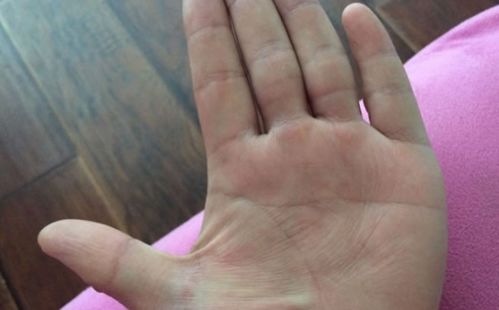 断掌的男人活多少岁(左手断掌男人多大能结婚)