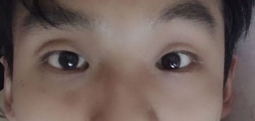 狐狸眼的男人丑吗(这是什么眼型)