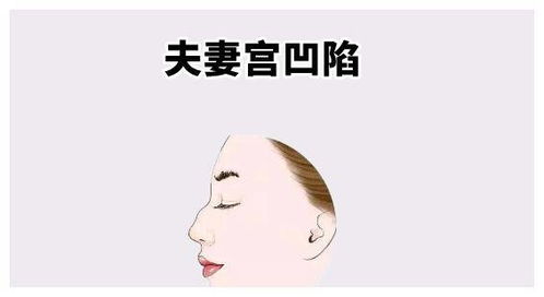 太阳凹陷是不是一定婚姻不好 太阳落陷夫妻宫会离婚吗