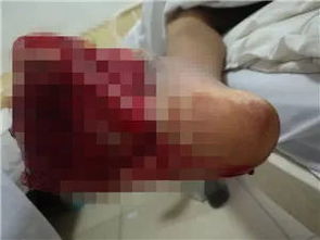 女人不小心右脚踩到人屎 本命年踩到人屎有啥兆头