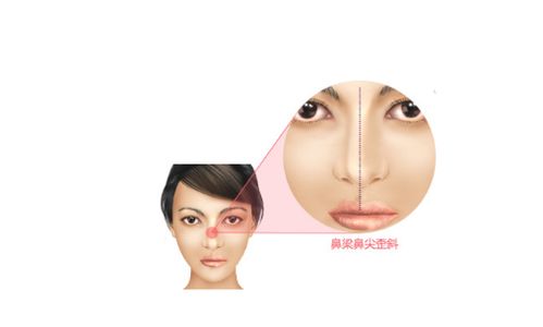 女人最克夫的4个脸型 女人最命苦的五种鼻子图解