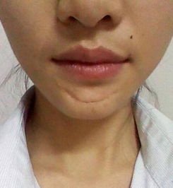 女人额头有疤痕好不好 女孩子额头有疤好不好